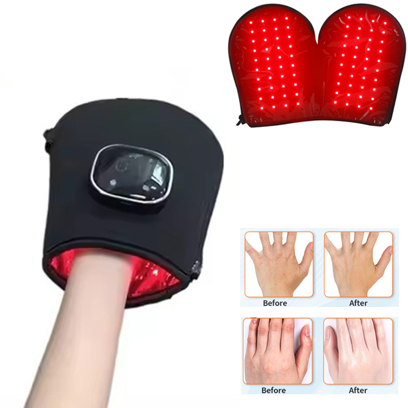 อุปกรณ์บำบัดด้วยแสงสีแดงรุ่นให - Galvanic Skin Sensor บทวิจารณ์และราคา